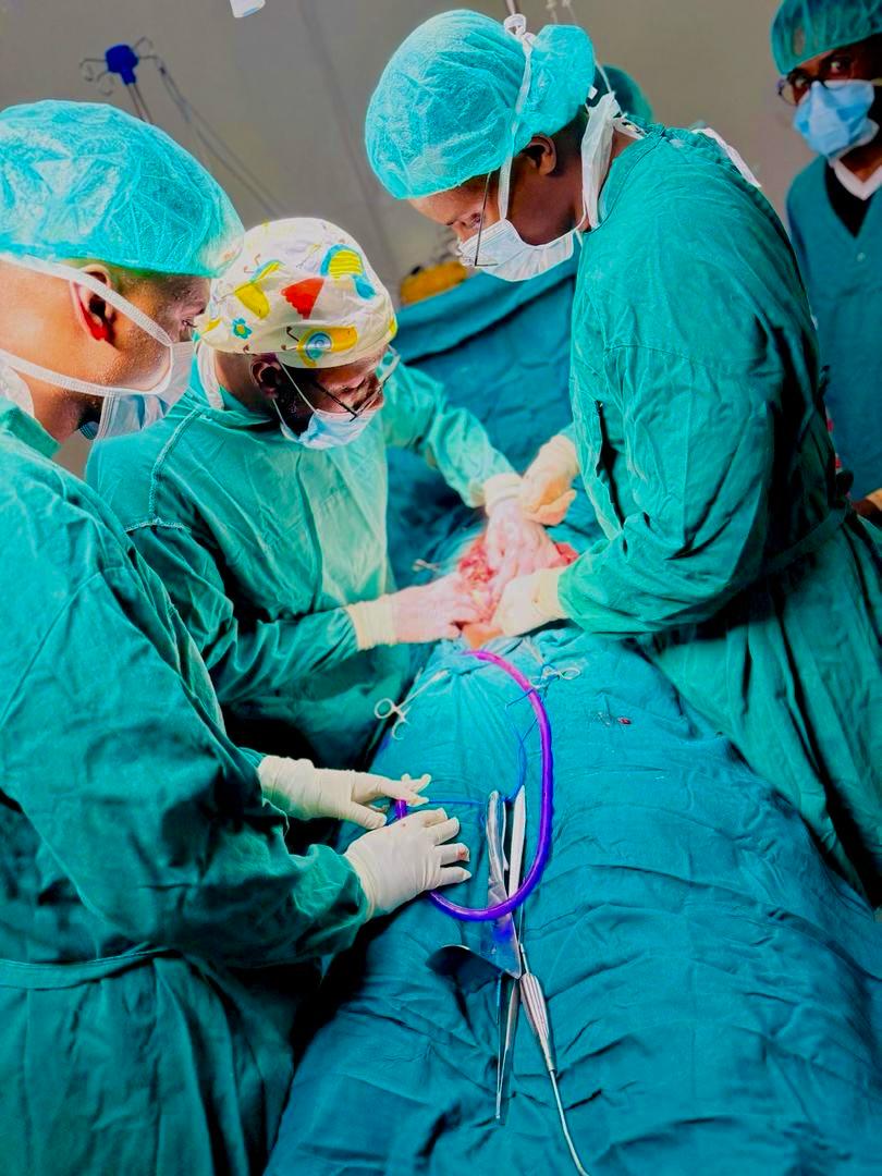 Ex-laparotomy procedure